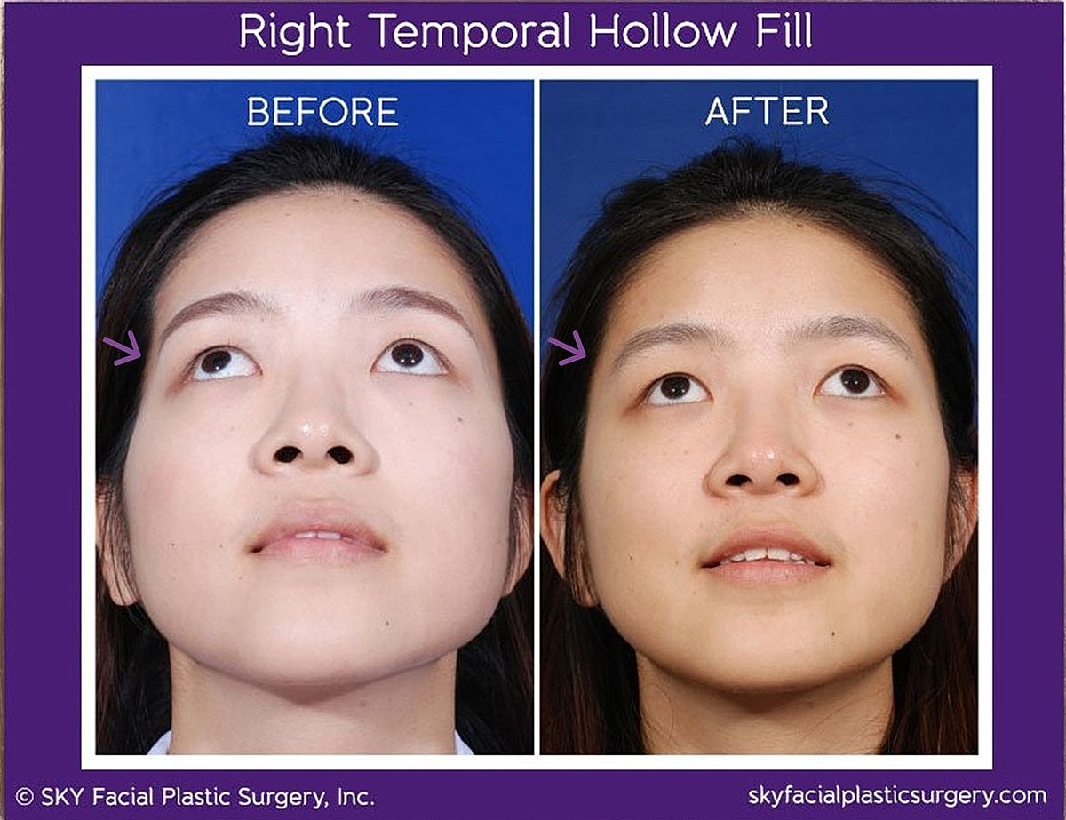 Reconstructive Surgery Before & After