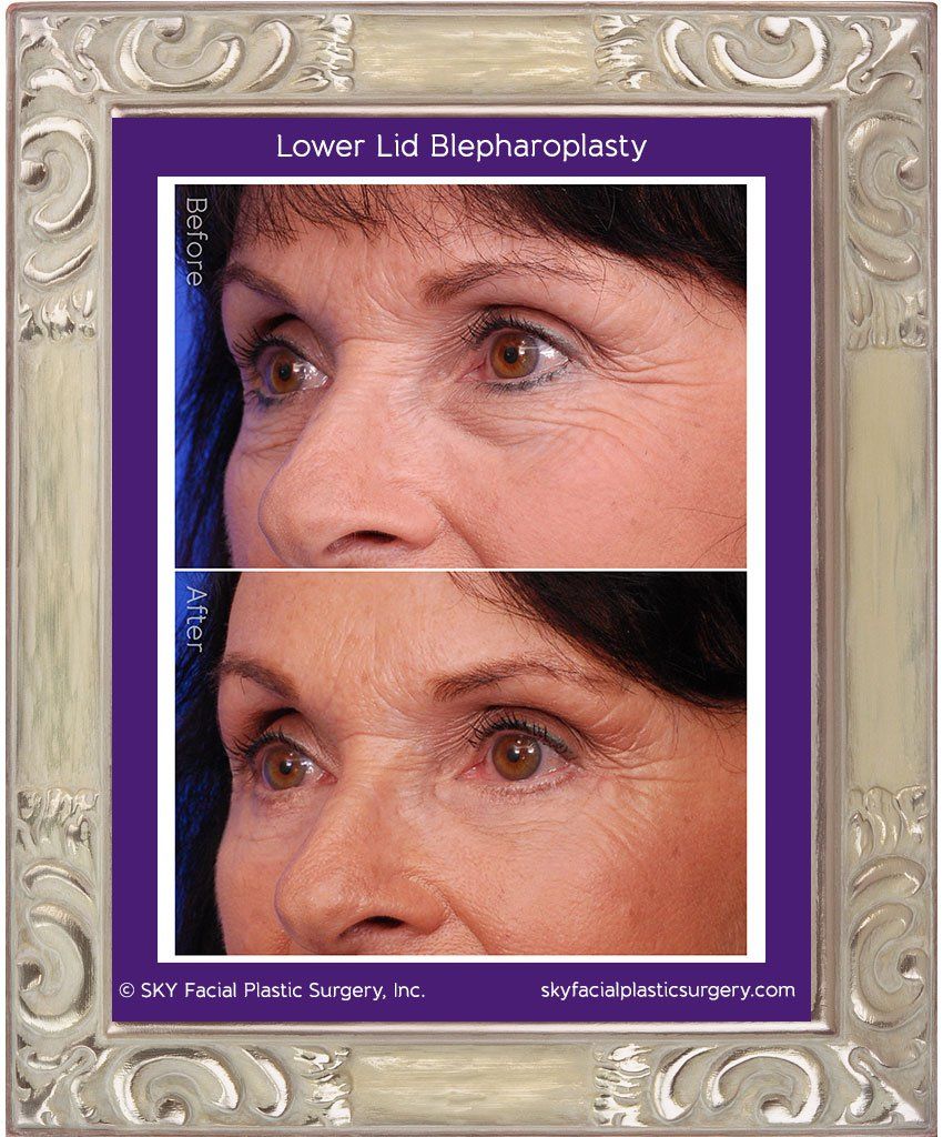 Aging gracefully or just aging? When injectables are not enough.